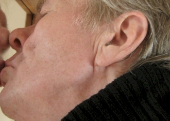 Sindromi narcisistiche