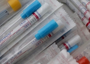 Covid in Molise: «150 tamponi da buttare»