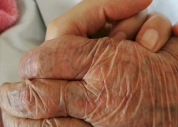 MOLISE, UN CASO DI SCELLERATA GESTIONE DELLA SANITÀ