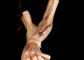 Responsabile dell’autolesionismo è il non aver sensazione del proprio essere