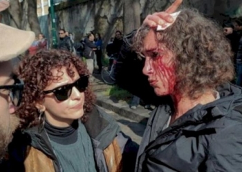 La censura del manganello